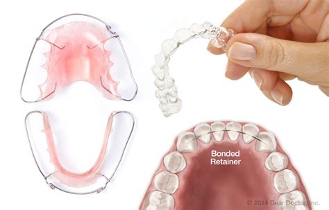 retainer meaning in tagalog|retention in Tagalog .